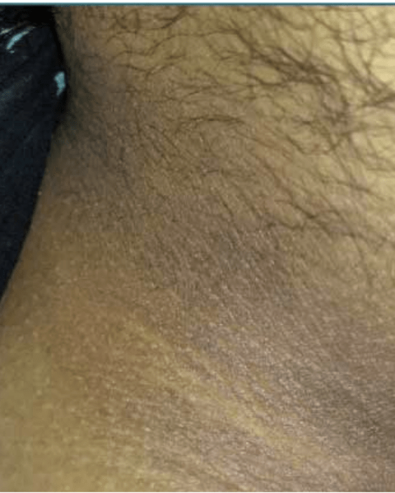 1 1
