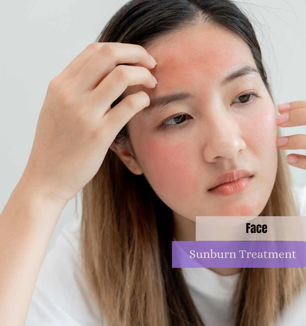 Face SunBurn