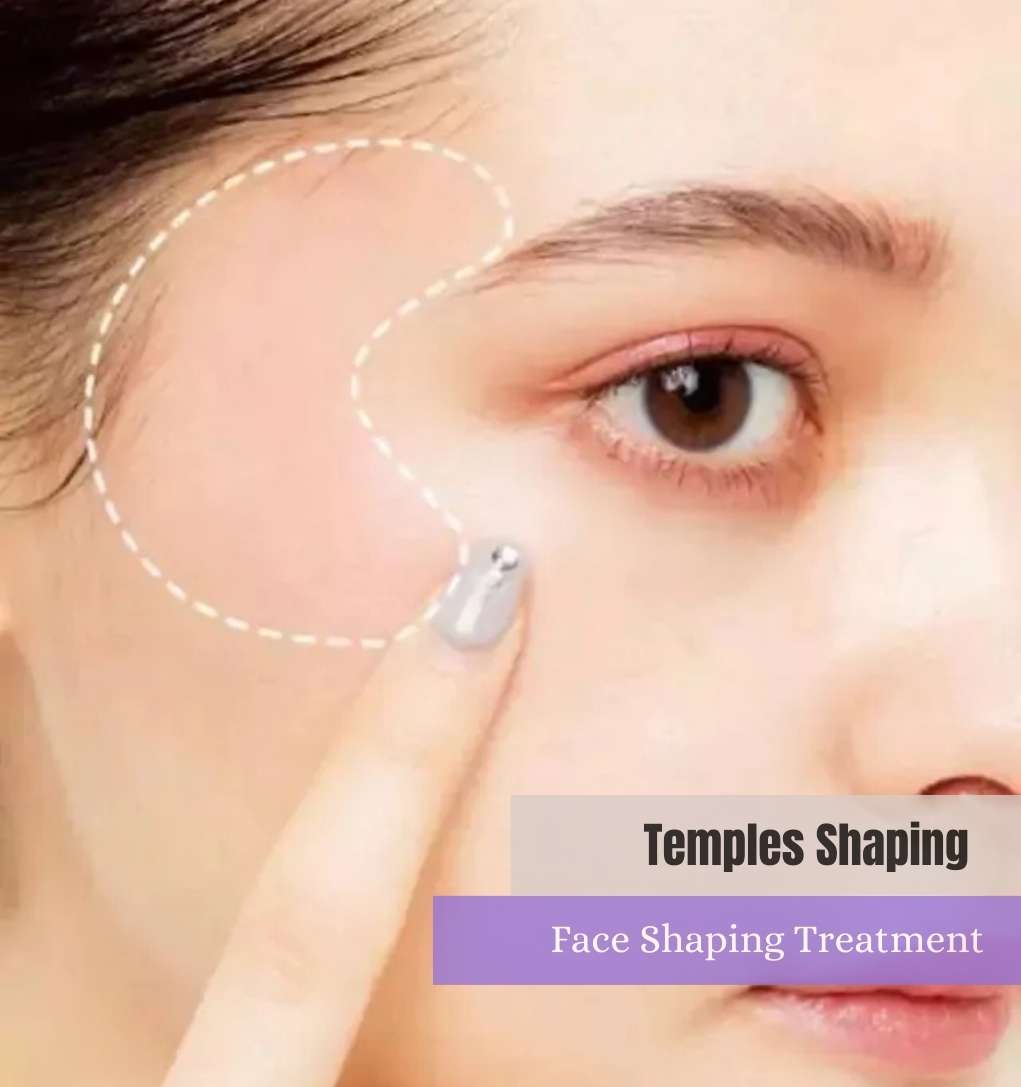 Temples Shaping